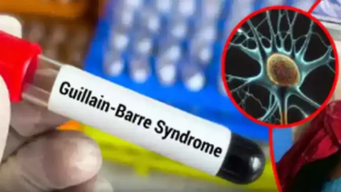 Guillain Barre syndrome