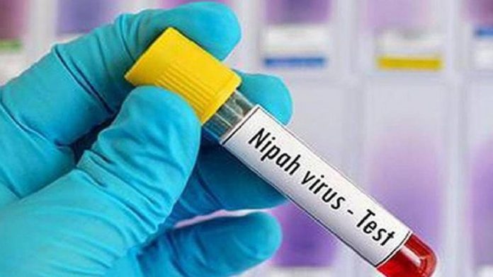 Nipah virus